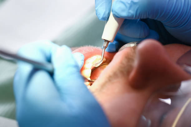 Best Emergency Dental Care for Abscessed Tooth in Hazel Green, AL