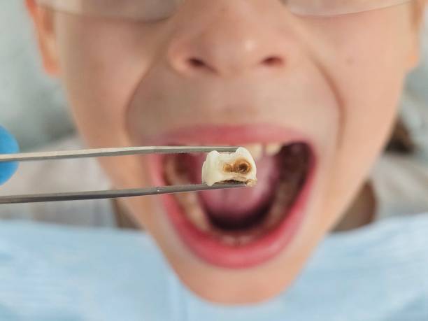 Best Pediatric Emergency Dentist in Hazel Green, AL